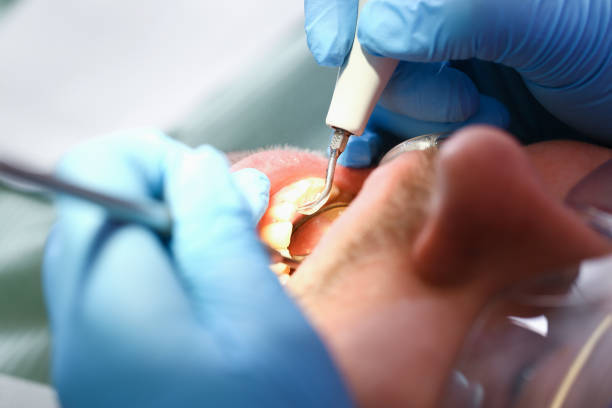 Best Weekend Emergency Dental Services in San Ramon, CA
